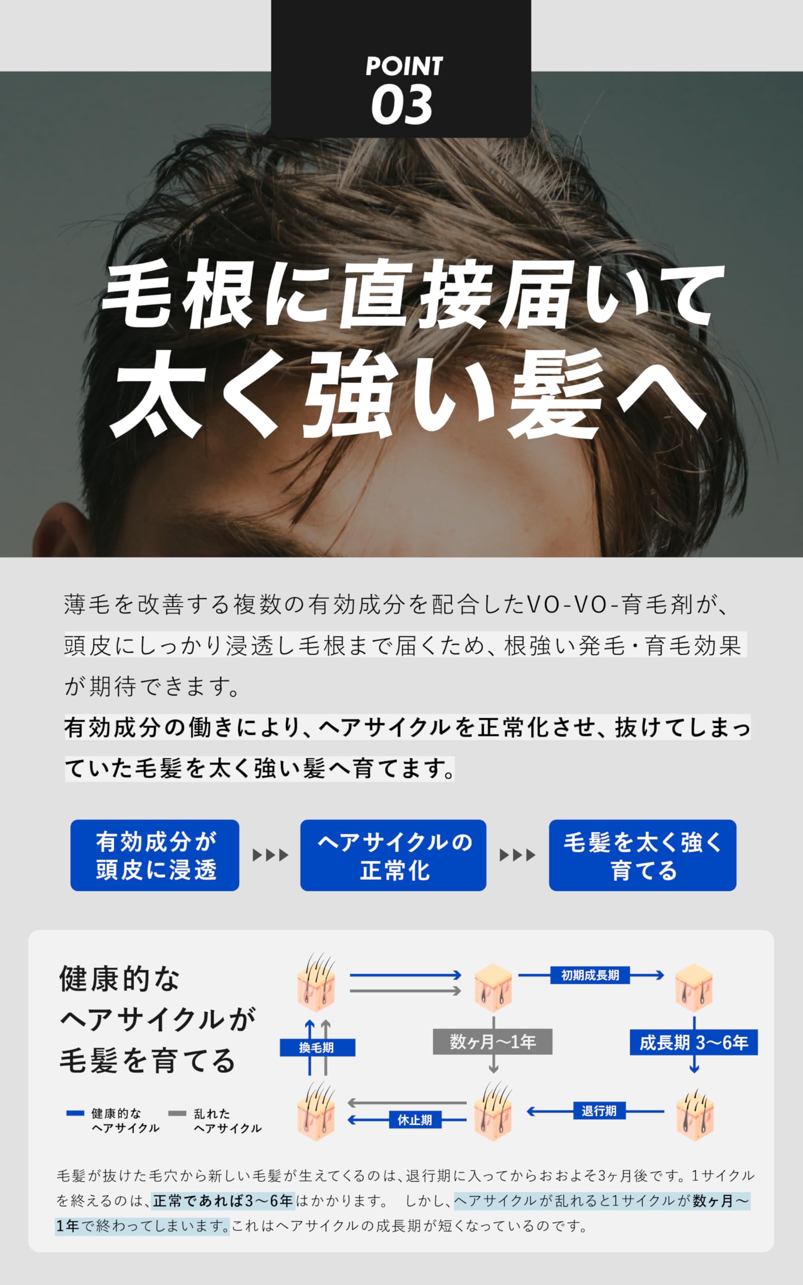 Amazon | 【朝倉未来プロデュース】 VO-VO- 育毛剤 リデンシル配合